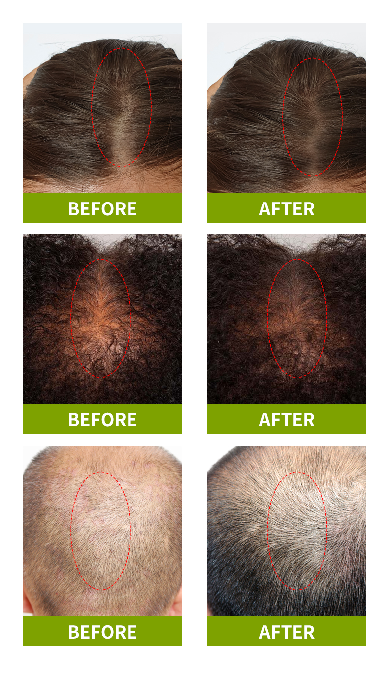 स्युल्ली草本护发油_07 स्युल्ली草本护发油_08 