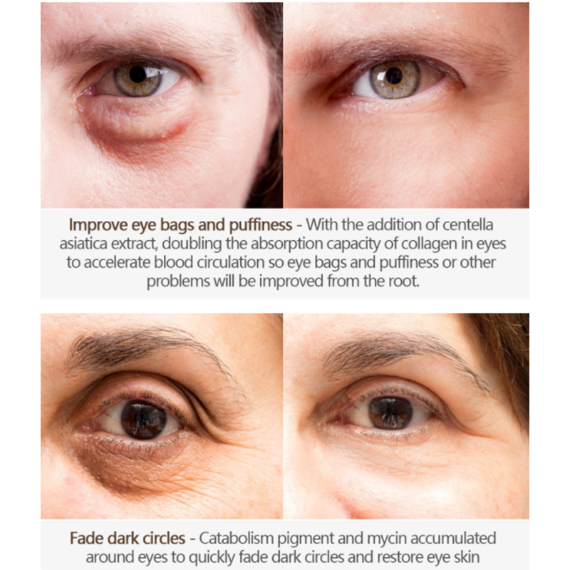 एप्लिकेटर के साथ कस्टम एंटी रिंकल आई क्रीम (2) 